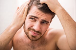 Príčiny straty vlasov u mužov