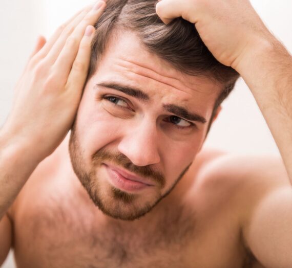 Príčiny straty vlasov u mužov: Hlavný vinníci